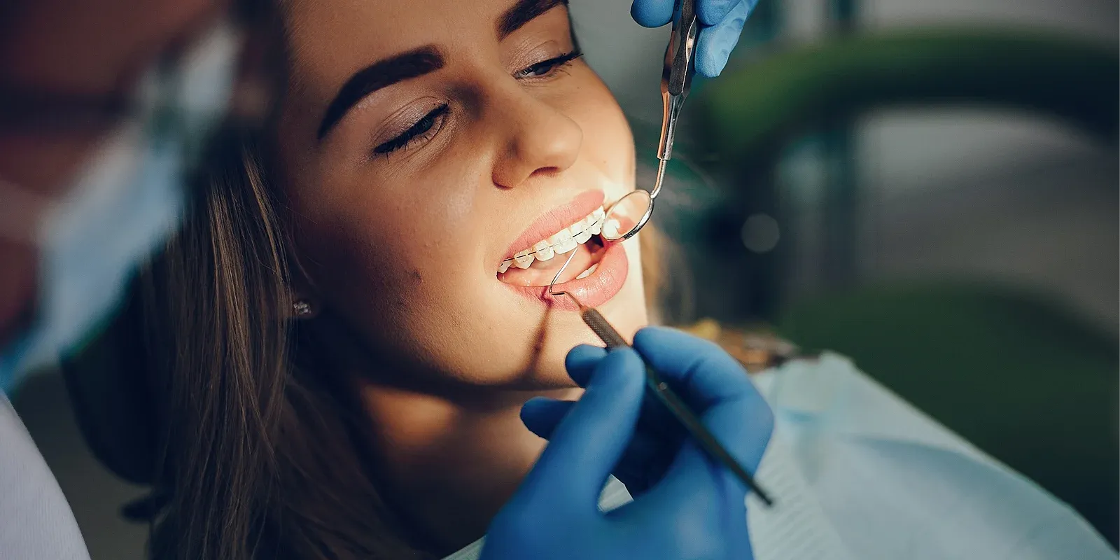 Top 10 Questions to Ask Before Starting Orthodontic Treatment