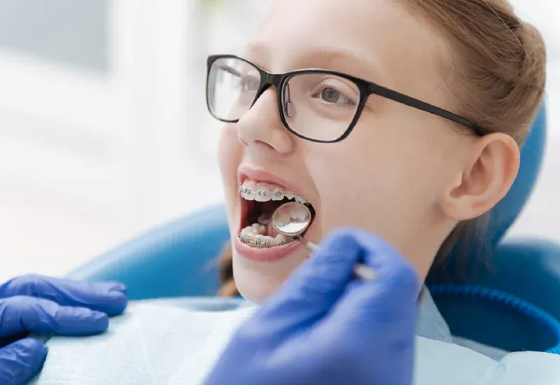 Top Benefits of Early Orthodontic Treatment for Kids